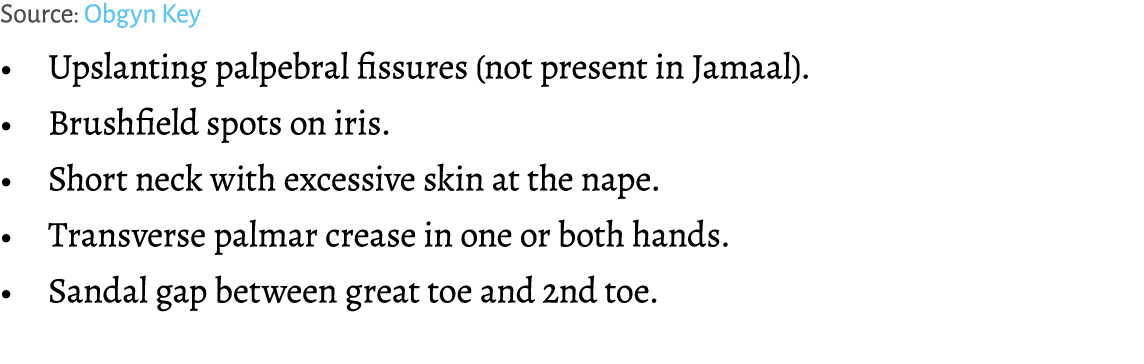 Source: Obgyn Key • Upslanting palpebral fissures (not present in Jamaal). • Brushfield spots on iris. • Short neck w...