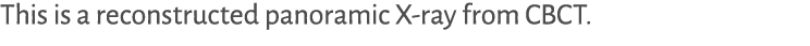 This is a reconstructed panoramic X-ray from CBCT.