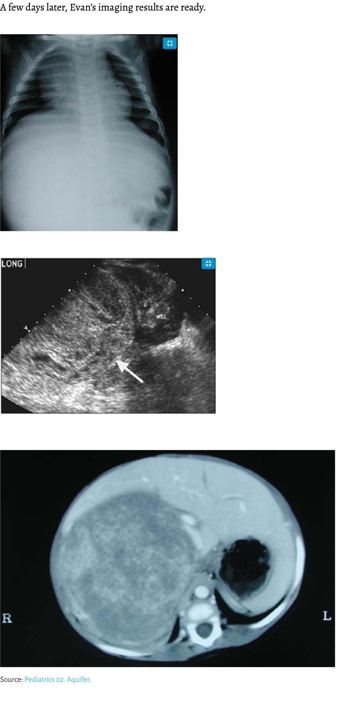 A few days later, Evan’s imaging results are ready. ￼ ￼ ￼ Source: Pediatrics 02. Aquifer.