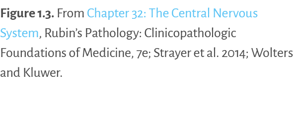 Figure 1.3. ﻿From Chapter 32: The Central Nervous System, Rubin’s Pathology: Clinicopathologic Foundations of Medicin...