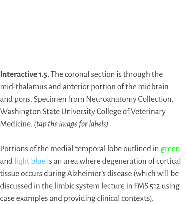 Interactive 1.5. ﻿The coronal section is through the mid thalamus and anterior portion of the midbrain and pons. Spec...