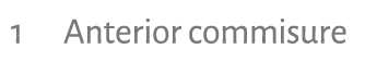 1 Anterior commisure 