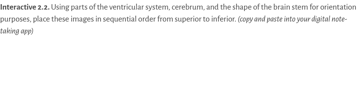 Interactive 2.2. Using parts of the ventricular system, cerebrum, and the shape of the brain stem for orientation pur...