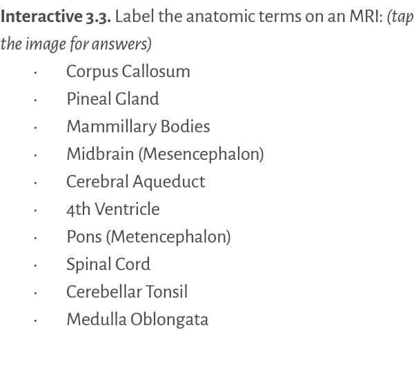 Interactive 3.3. ﻿Label the anatomic terms on an MRI: (tap the image for answers) • Corpus Callosum • Pineal Gland • ...