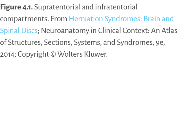Figure 4.1. ﻿Supratentorial and infratentorial compartments. From Herniation Syndromes: Brain and Spinal Discs; Neuro...