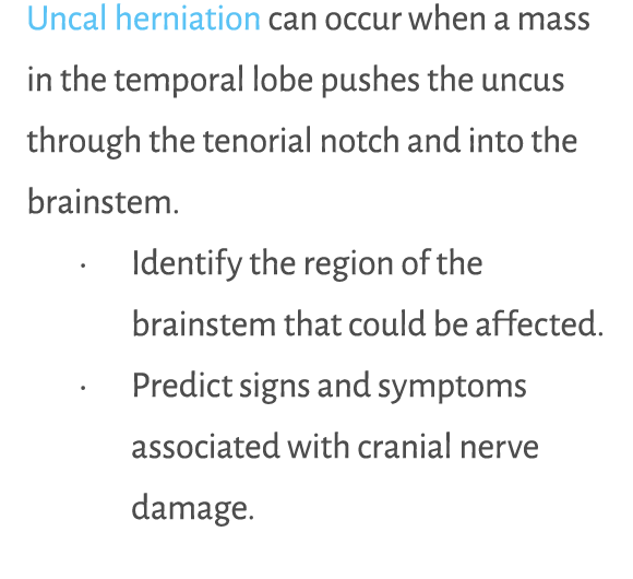 Uncal herniation can occur when a mass in the temporal lobe pushes the uncus through the tenorial notch and into the ...