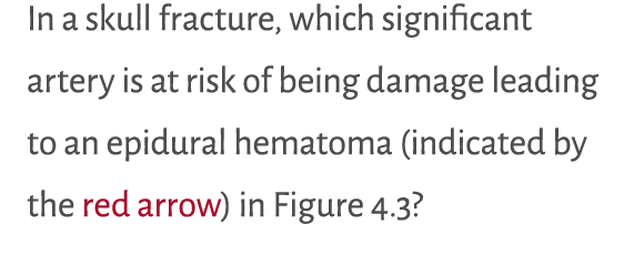 In a skull fracture, which significant artery is at risk of being damage leading to an epidural hematoma (indicated b...