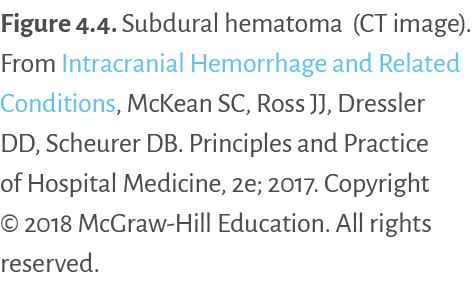 Figure 4.4. Subdural hematoma (CT image). From Intracranial Hemorrhage and Related Conditions, McKean SC, Ross JJ, Dr...