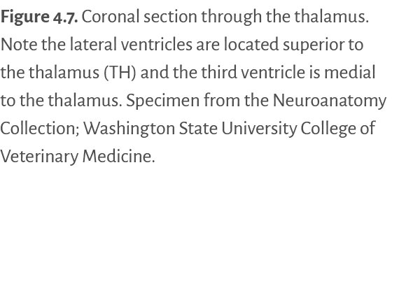 Figure 4.7. Coronal section through the thalamus. Note the lateral ventricles are located superior to the thalamus (T...