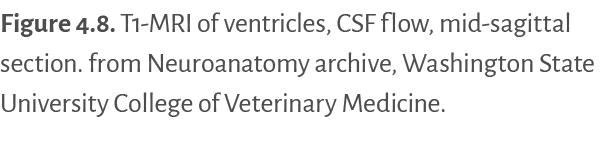 Figure 4.8. T1 MRI of ventricles, CSF flow, mid sagittal section. from Neuroanatomy archive, Washington State Univers...