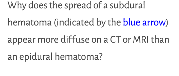 Why does the spread of a subdural hematoma (indicated by the blue arrow) appear more diffuse on a CT or MRI than an e...