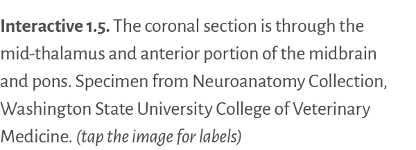 Interactive 1 5   The coronal section is through the mid-thalamus and anterior portion of the midbrain and pons  Spec   