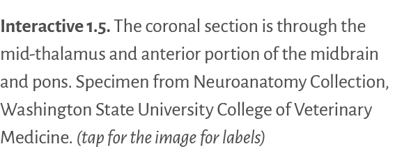 Interactive 1 5   The coronal section is through the mid-thalamus and anterior portion of the midbrain and pons  Spec   