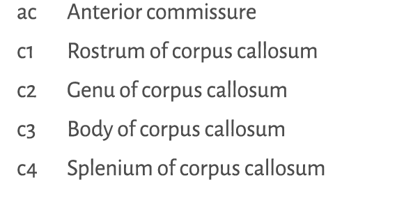 ac Anterior commissure c1 Rostrum of corpus callosum c2 Genu of corpus callosum c3 Body of corpus callosum c4 Spleniu   