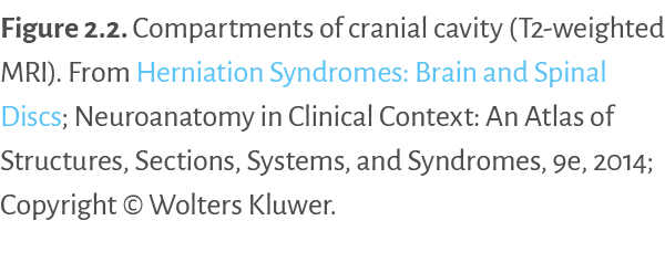 Figure 2 2   Compartments of cranial cavity (T2-weighted MRI)  From Herniation Syndromes: Brain and Spinal Discs; Neu   