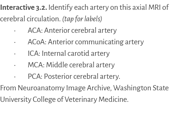 Interactive 3 2   Identify each artery on this axial MRI of cerebral circulation  (tap for labels)   ACA: Anterior ce   