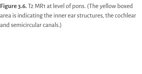 Figure 3 6   T2 MR1 at level of pons  (The yellow boxed area is indicating the inner ear structures, the cochlear and   