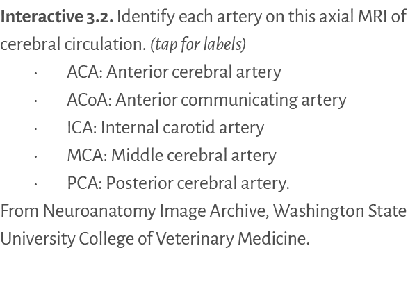 Interactive 3.2. ﻿Identify each artery on this axial MRI of cerebral circulation. (tap for labels) • ACA: Anterior ce...