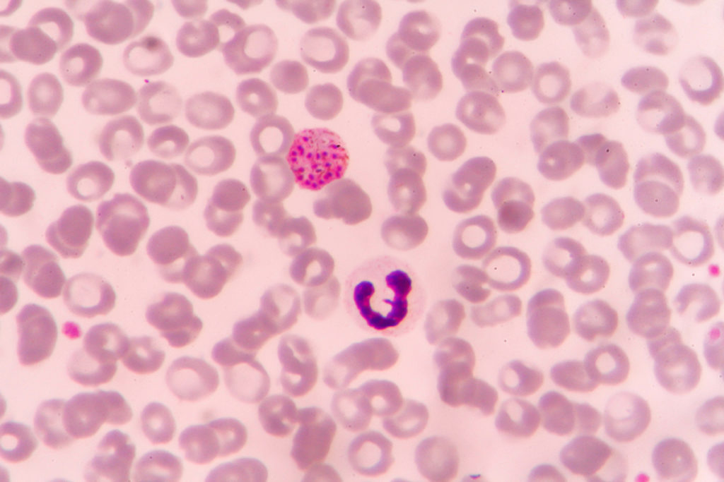 planetary-health-vector-borne-malaria-parasite-image