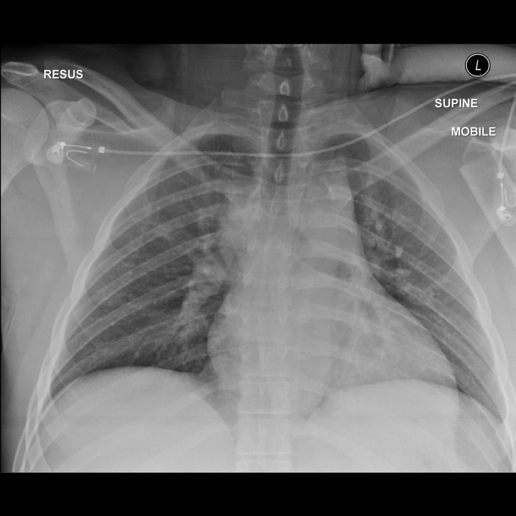 radiology-intro-imaging-xray-image2