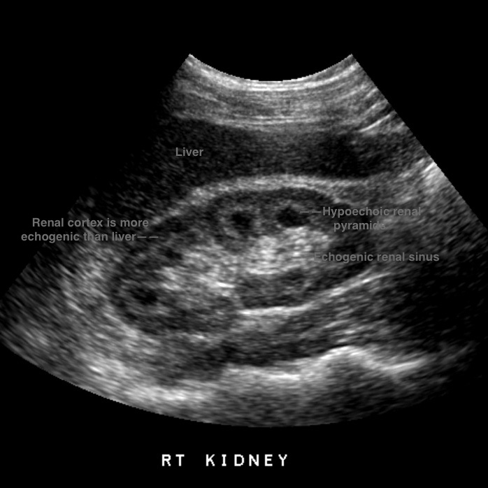 ultrasound-kidney-image