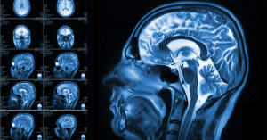 featured-image-mri