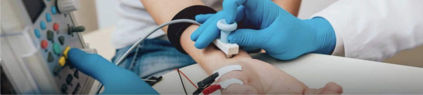 A nerve conduction study (or nerve conduction velocity, “NCV,” test) involves measuring how fast a nerve impulse travels between electrodes.