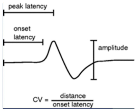 Electrical activity of nerves is measured as:  Sensory nerve action potential (SNAP) and  Compound muscle action potential (CMAP)   Axonal neuropathy has decreased amplitude  Demyelination shows reduced conduction velocity.