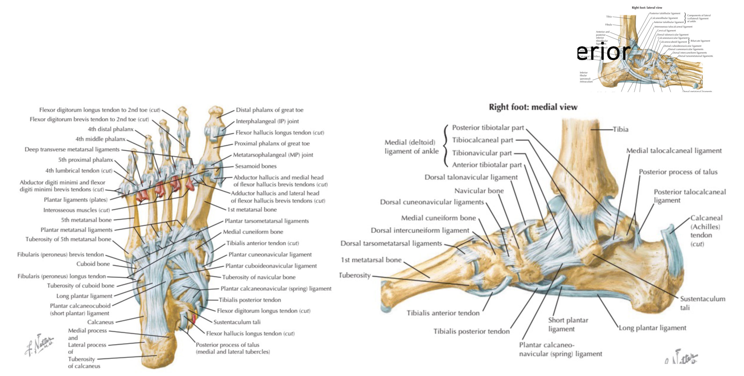 Charcot-Marie-Tooth Disease: Hereditary Motor and Sensory Neuropathy ...