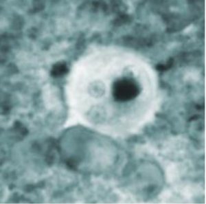 e-histolytica-cyst-image