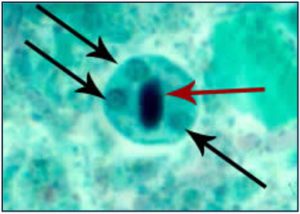 protozoa-e-histolytica-cyst