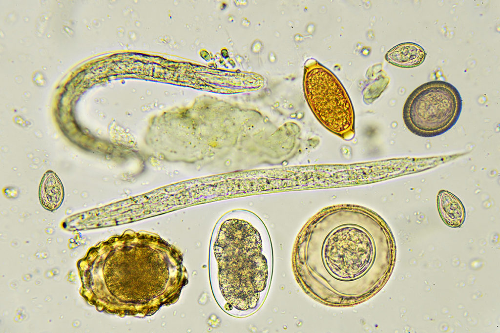 intestinal-helminths-microscopic-image