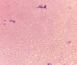 Salmonella typhi, microscopic view of gram-stained slide.