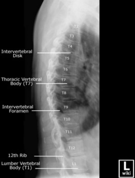Figure 2.20.
