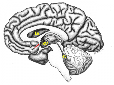 Figure 4.6. Diagram of the ventricular system.  From Neuroanatomy: A Laboratory Guide (2e);  Jansen and Lampa (2018).